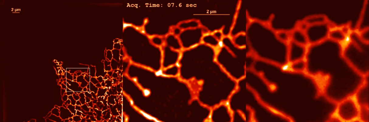 ER клетки COS7, меченной SGFP2-sec61b. Тонкие движения эндоплазматической сети могут быть зафиксированы и визуализированы с помощью реконструкции.