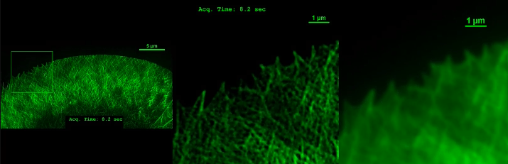 Конус роста клетки NG108, меченной GFP-Lifeact для F-actin.