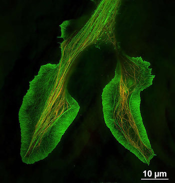 Двухцветное изображение TIRF-SIM конуса роста клетки NG108, меченной Alexa Fluor® 488 для F-actin (зеленый) и Alexa Fluor® 555 для микротрубочек (оранжевый) Размер изображения 66 x 66 мкм с объективом 100X