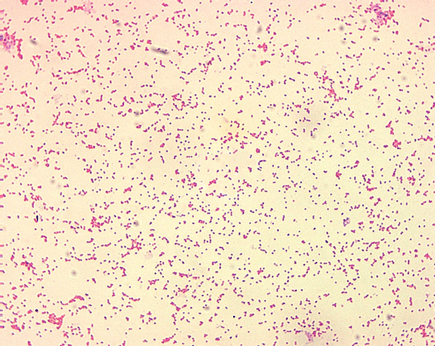 Бруцеллез по ГОСТ 33675-2015