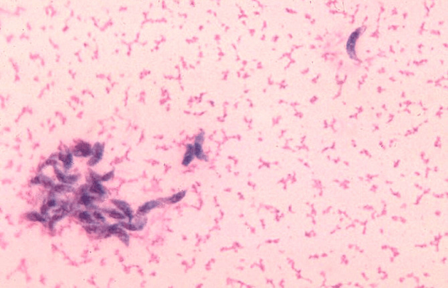 Токсоплазмоз по МУ