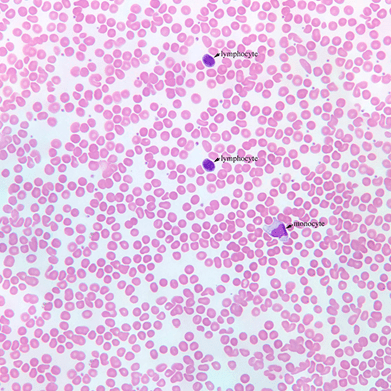 Лейкоцитоз по ГОСТ 25382-82